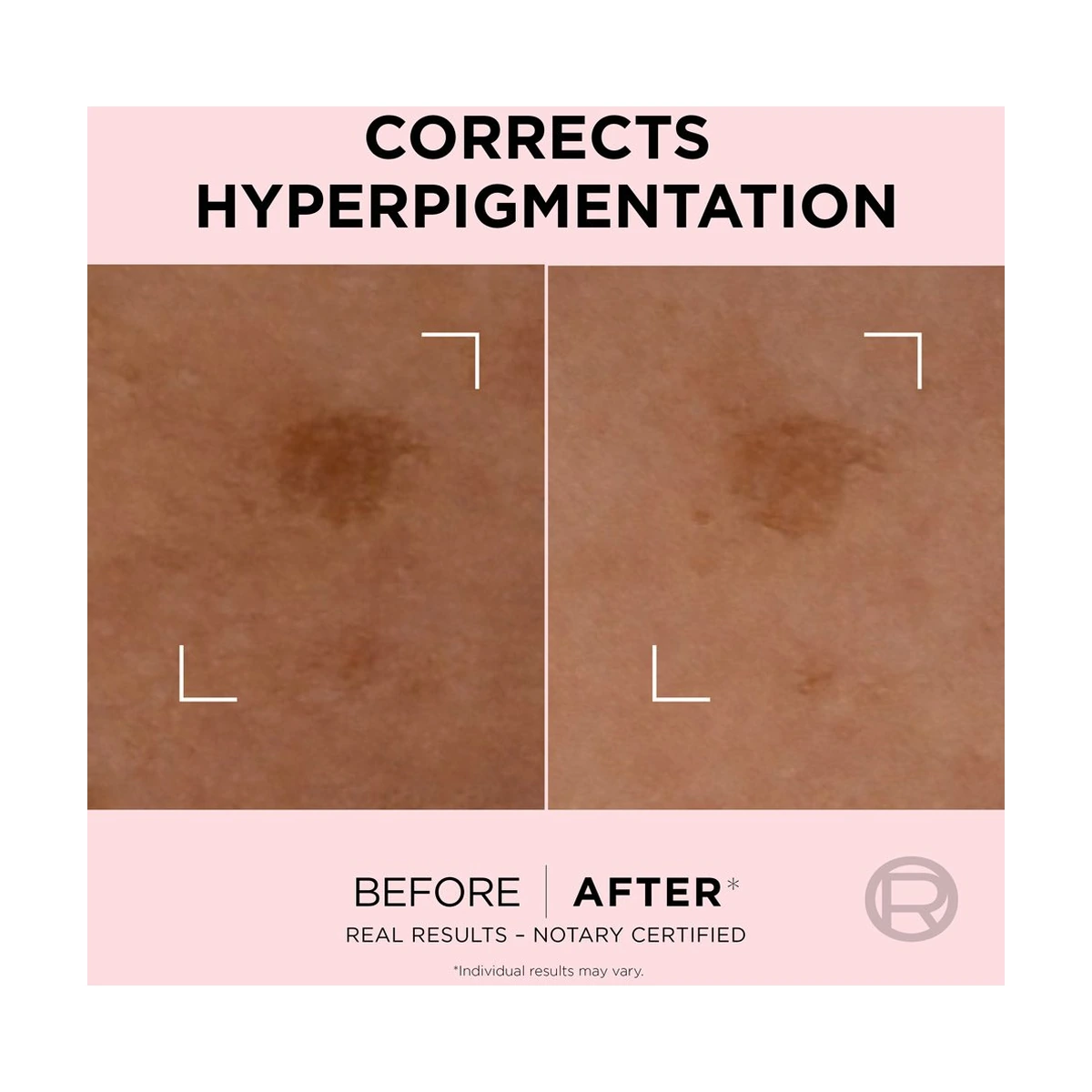 Age Perfect Golden Age Rapid Spot Corrector