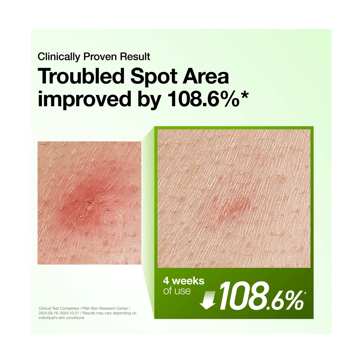 Azelaic Acid 10 Hyaluron Redness Soothing Serum