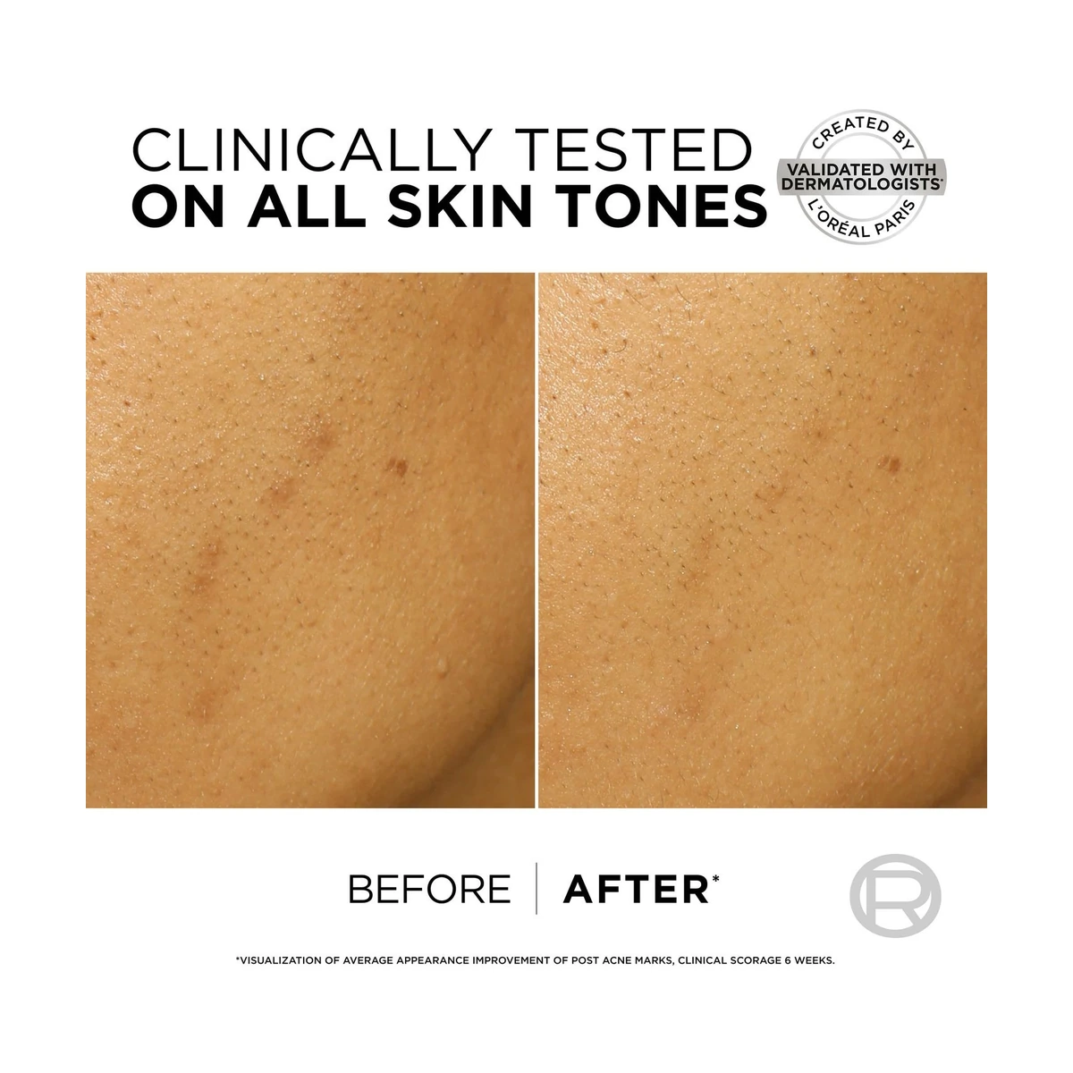 Bright Reveal Dark Spot Exfoliant "Snake" Peel With 25% [AHA + BHA + PHA] And Niacinamide